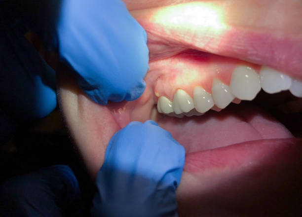 Emergency Dentist Open Today in NY